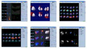 Read more about the article Cedars-Sinai Research Recognized at SCCT 2020