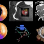 Advances in Nuclear Cardiology, Cardiac CT and Cardiac MRI: 37th Annual Case Review with the Experts – January 2024