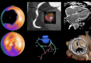 Advances in Nuclear Cardiology, Cardiac CT and Cardiac MRI: 37th Annual Case Review with the Experts – January 2024