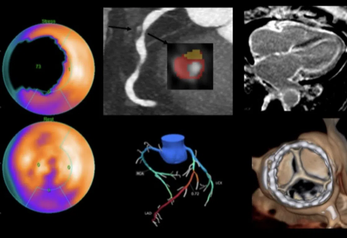 Read more about the article Advances in Nuclear Cardiology, Cardiac CT and Cardiac MRI: 37th Annual Case Review with the Experts – January 2024